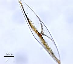 dinoflagellate PyroDino under microscope